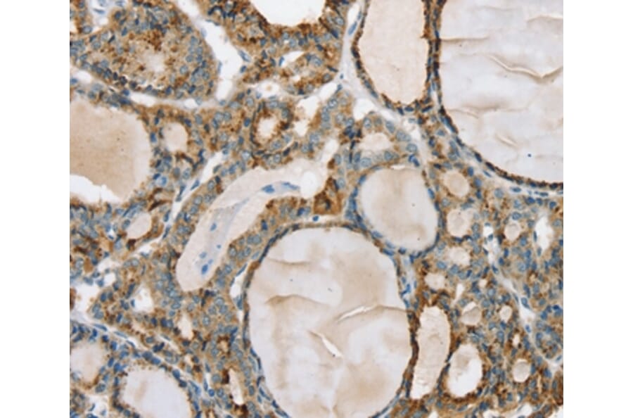 Immunohistochemistry - PHKB Antibody from Signalway Antibody (36692) - Antibodies.com