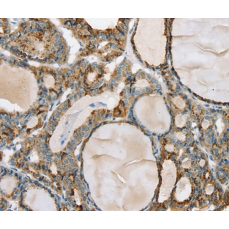 Immunohistochemistry - PHKB Antibody from Signalway Antibody (36692) - Antibodies.com