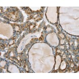 Immunohistochemistry - PHKB Antibody from Signalway Antibody (36692) - Antibodies.com