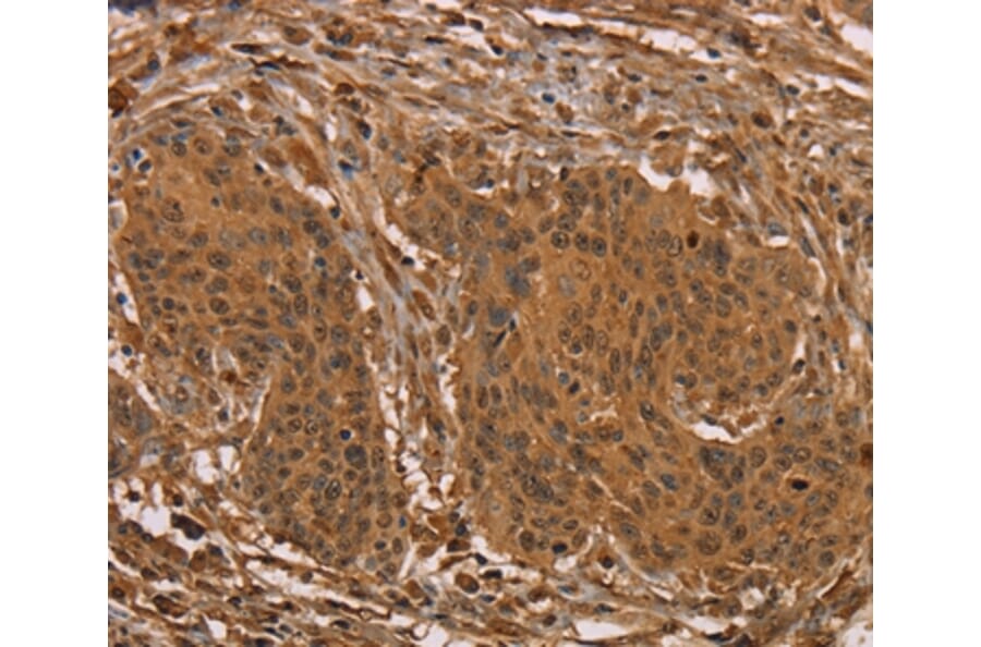 Immunohistochemistry - PRC1 Antibody from Signalway Antibody (36701) - Antibodies.com