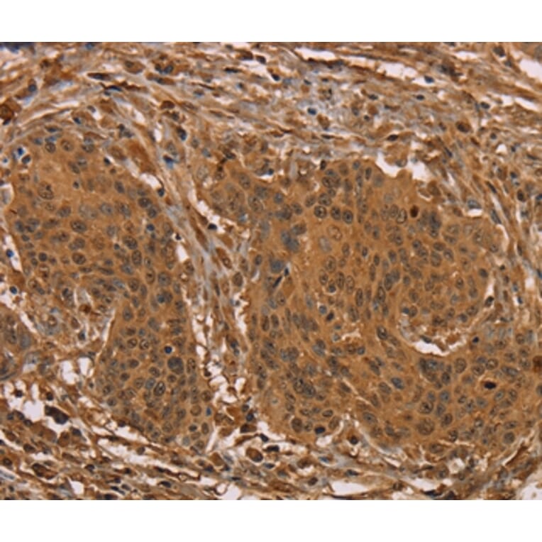 Immunohistochemistry - PRC1 Antibody from Signalway Antibody (36701) - Antibodies.com