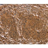 Immunohistochemistry - PRC1 Antibody from Signalway Antibody (36701) - Antibodies.com