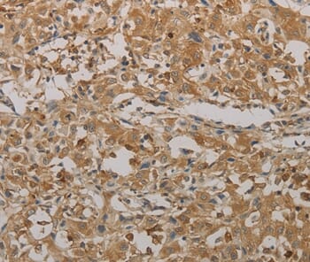 Immunohistochemical analysis of paraffin-embedded Human brain tissue using #36721 at dilution 1/25.