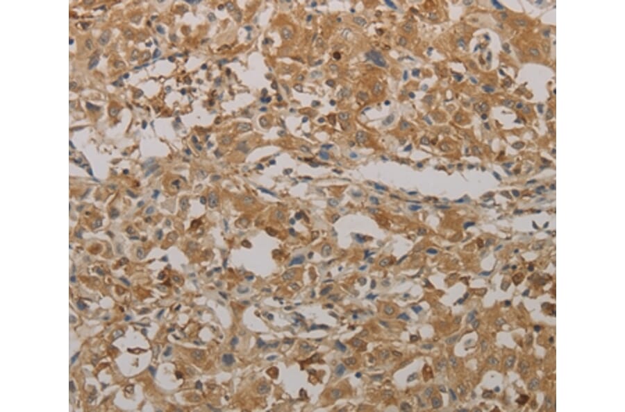 Immunohistochemistry - AATK Antibody from Signalway Antibody (36721) - Antibodies.com