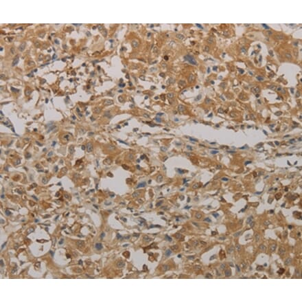 Immunohistochemistry - AATK Antibody from Signalway Antibody (36721) - Antibodies.com