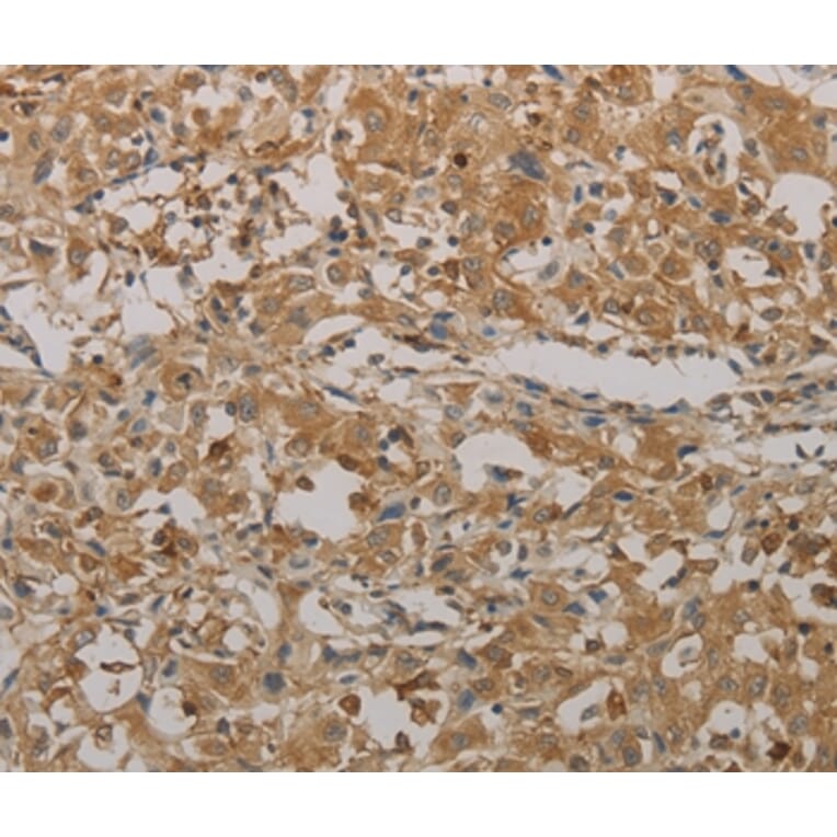 Immunohistochemistry - AATK Antibody from Signalway Antibody (36721) - Antibodies.com