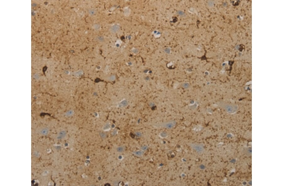 Immunohistochemistry - AATK Antibody from Signalway Antibody (36721) - Antibodies.com