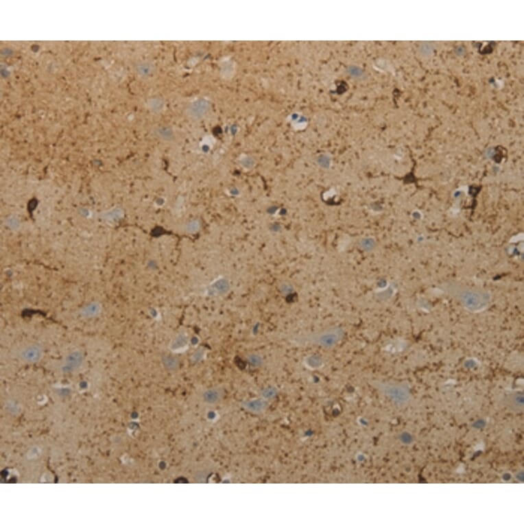 Immunohistochemistry - AATK Antibody from Signalway Antibody (36721) - Antibodies.com
