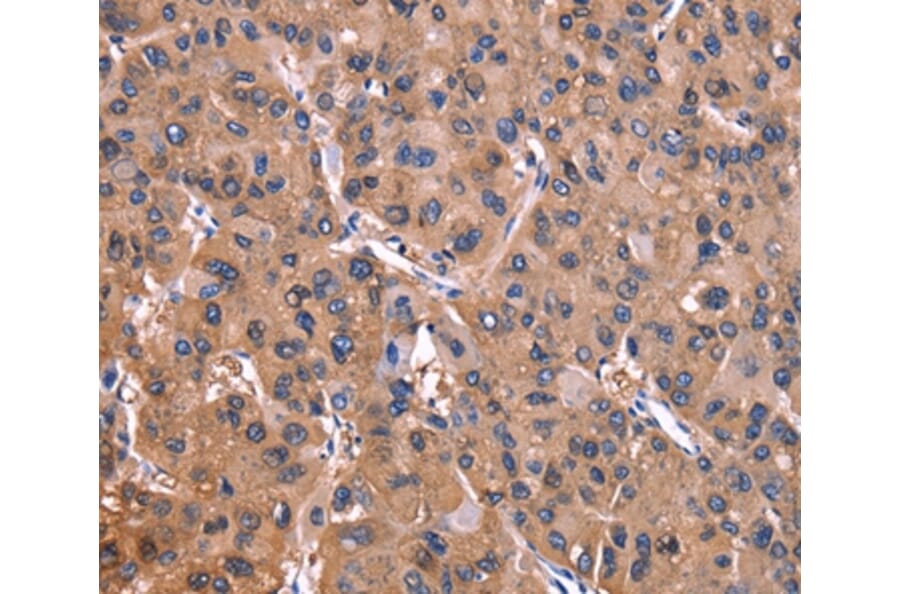Immunohistochemistry - ADM2 Antibody from Signalway Antibody (36727) - Antibodies.com