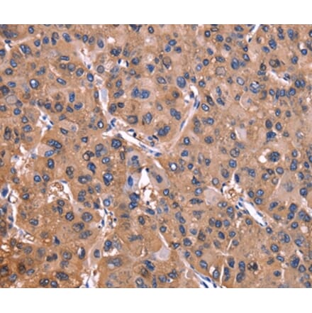 Immunohistochemistry - ADM2 Antibody from Signalway Antibody (36727) - Antibodies.com