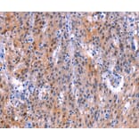 Immunohistochemistry - ADM2 Antibody from Signalway Antibody (36727) - Antibodies.com