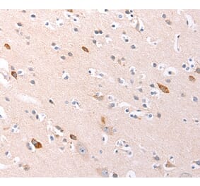 Immunohistochemistry - RALA Antibody from Signalway Antibody (36744) - Antibodies.com