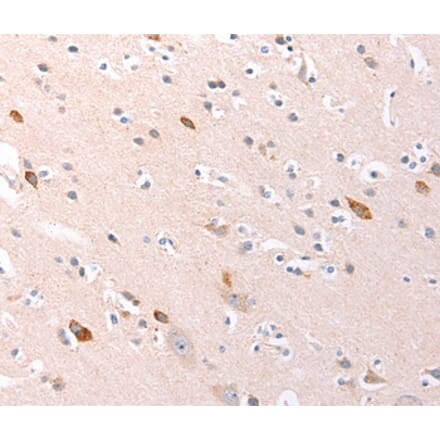 Immunohistochemistry - RALA Antibody from Signalway Antibody (36744) - Antibodies.com