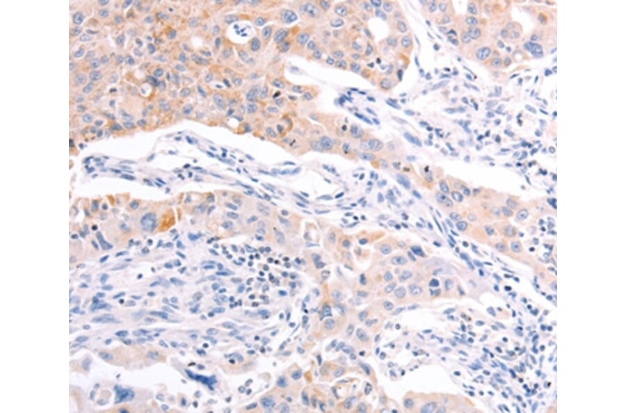 Immunohistochemistry - RALA Antibody from Signalway Antibody (36744) - Antibodies.com