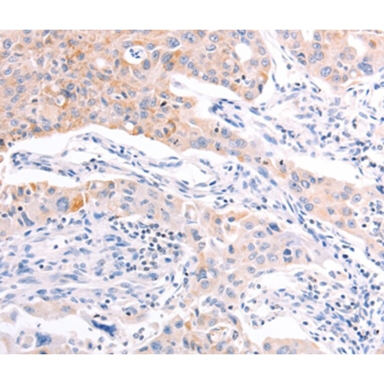 Immunohistochemistry - RALA Antibody from Signalway Antibody (36744) - Antibodies.com