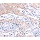 Immunohistochemistry - RALA Antibody from Signalway Antibody (36744) - Antibodies.com