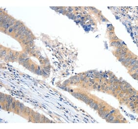 Immunohistochemistry - APOB Antibody from Signalway Antibody (36751) - Antibodies.com