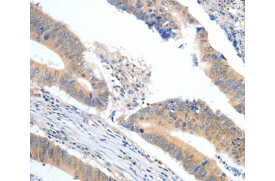 Immunohistochemistry - APOB Antibody from Signalway Antibody (36751) - Antibodies.com