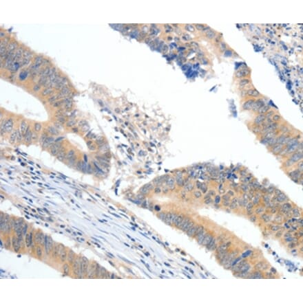 Immunohistochemistry - APOB Antibody from Signalway Antibody (36751) - Antibodies.com