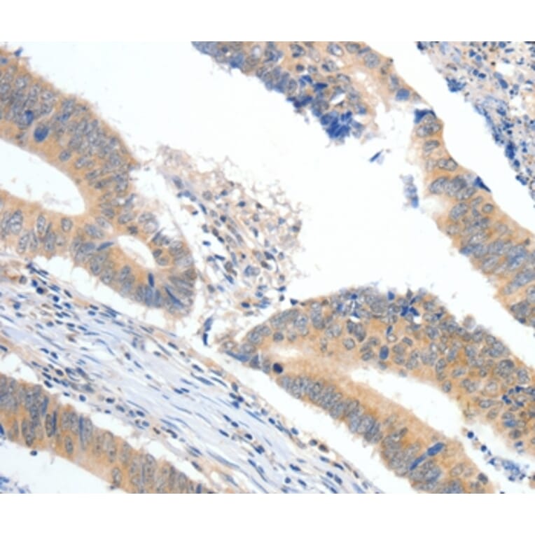 Immunohistochemistry - APOB Antibody from Signalway Antibody (36751) - Antibodies.com