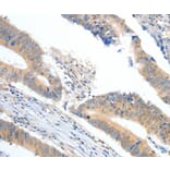 Immunohistochemistry - APOB Antibody from Signalway Antibody (36751) - Antibodies.com
