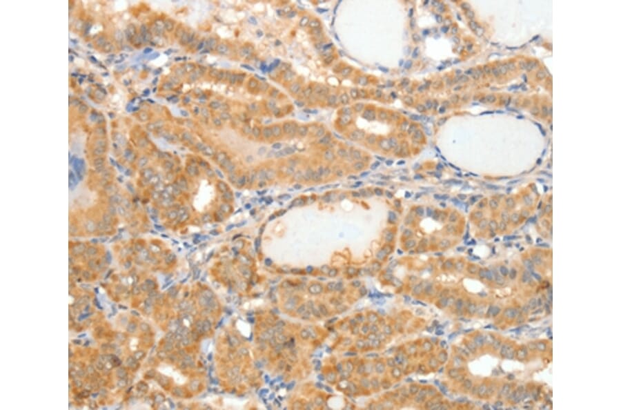Immunohistochemistry - APOB Antibody from Signalway Antibody (36751) - Antibodies.com