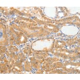 Immunohistochemistry - APOB Antibody from Signalway Antibody (36751) - Antibodies.com