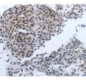 Immunohistochemistry - NPR1 Antibody from Signalway Antibody (36755) - Antibodies.com