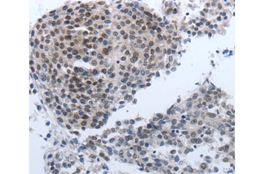 Immunohistochemistry - NPR1 Antibody from Signalway Antibody (36755) - Antibodies.com