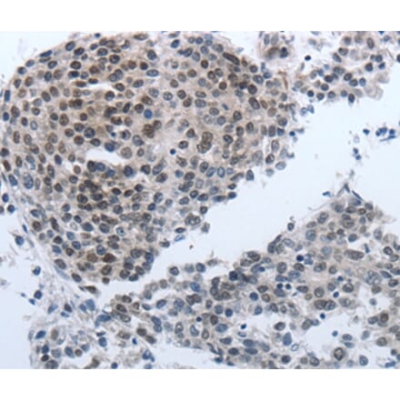 Immunohistochemistry - NPR1 Antibody from Signalway Antibody (36755) - Antibodies.com