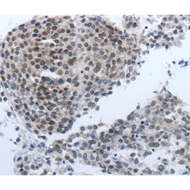 Immunohistochemistry - NPR1 Antibody from Signalway Antibody (36755) - Antibodies.com