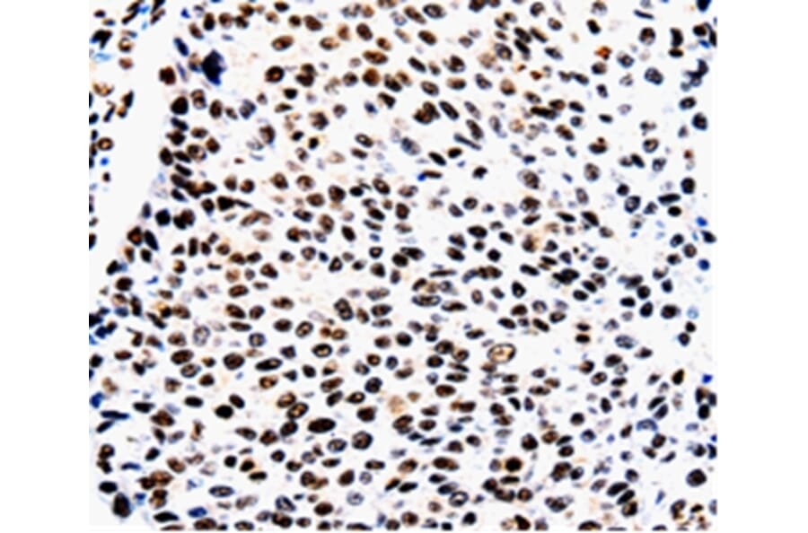 Immunohistochemistry - AQP2 Antibody from Signalway Antibody (36759) - Antibodies.com