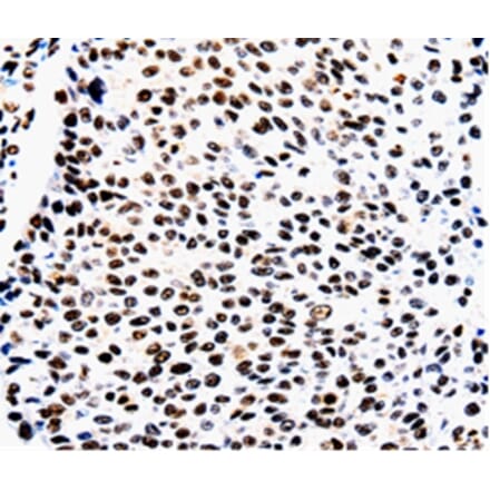 Immunohistochemistry - AQP2 Antibody from Signalway Antibody (36759) - Antibodies.com