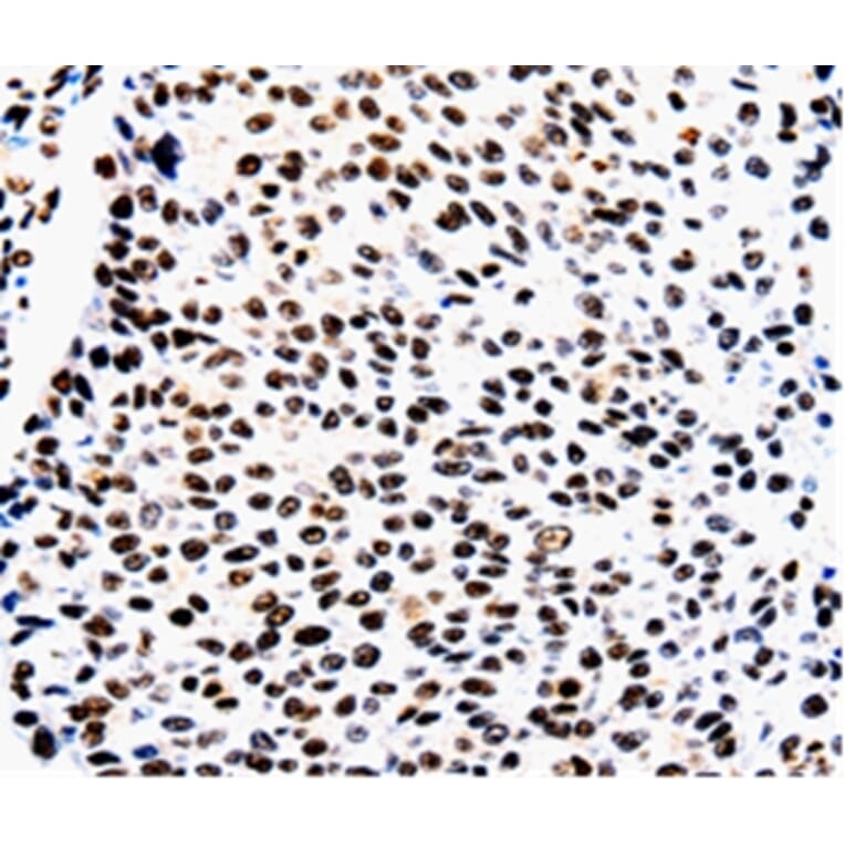 Immunohistochemistry - AQP2 Antibody from Signalway Antibody (36759) - Antibodies.com