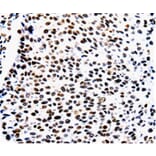 Immunohistochemistry - AQP2 Antibody from Signalway Antibody (36759) - Antibodies.com