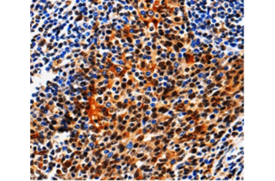 Immunohistochemistry - AQP2 Antibody from Signalway Antibody (36759) - Antibodies.com