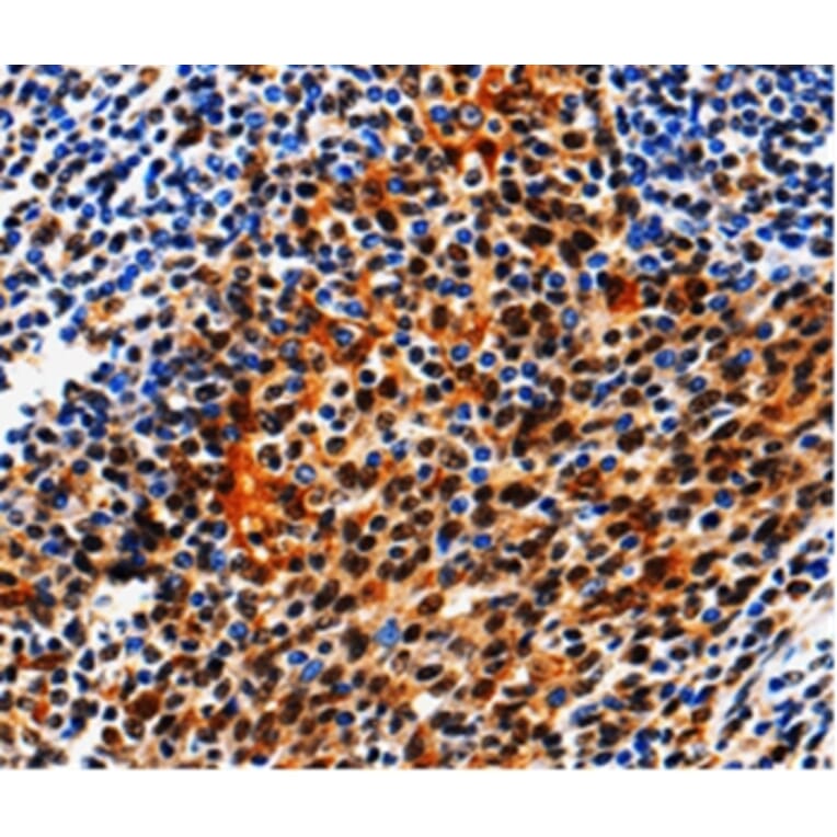 Immunohistochemistry - AQP2 Antibody from Signalway Antibody (36759) - Antibodies.com