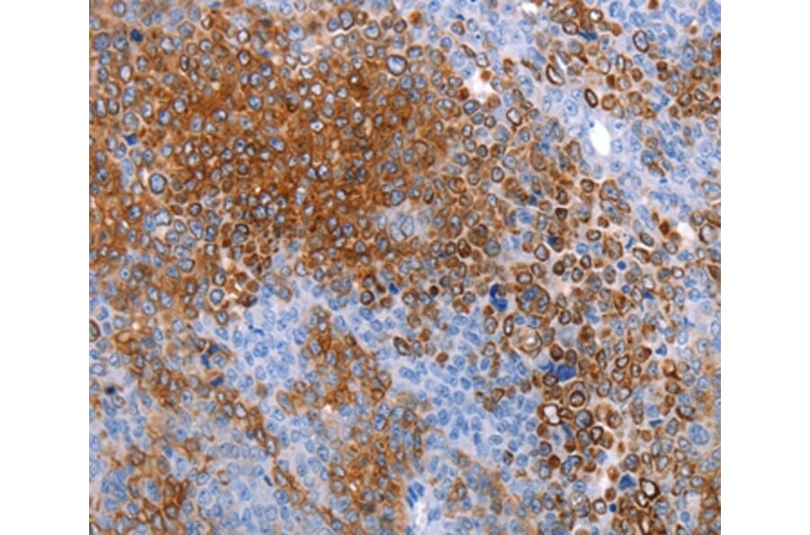 Immunohistochemistry - AQP5 Antibody from Signalway Antibody (36760) - Antibodies.com