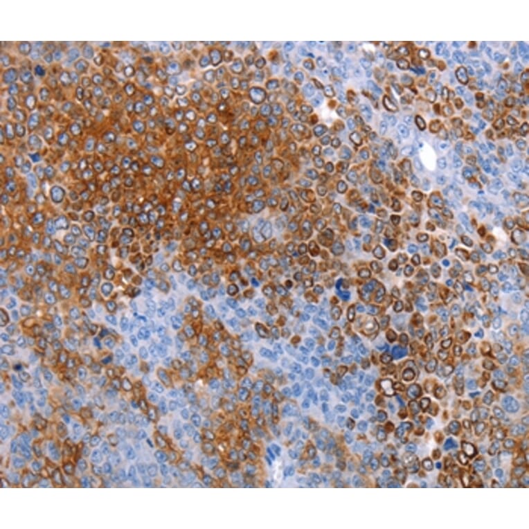 Immunohistochemistry - AQP5 Antibody from Signalway Antibody (36760) - Antibodies.com