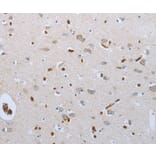 Immunohistochemistry - FGF1 Antibody from Signalway Antibody (36770) - Antibodies.com