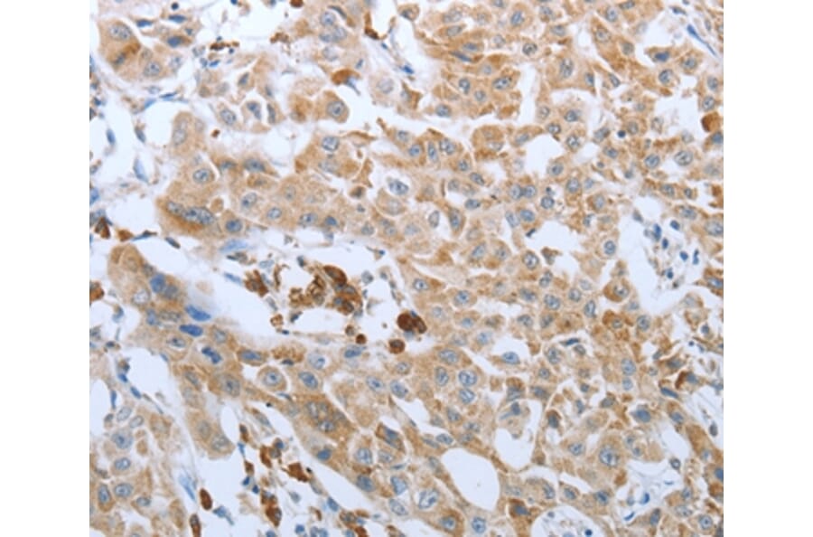 Immunohistochemistry - FGF1 Antibody from Signalway Antibody (36770) - Antibodies.com