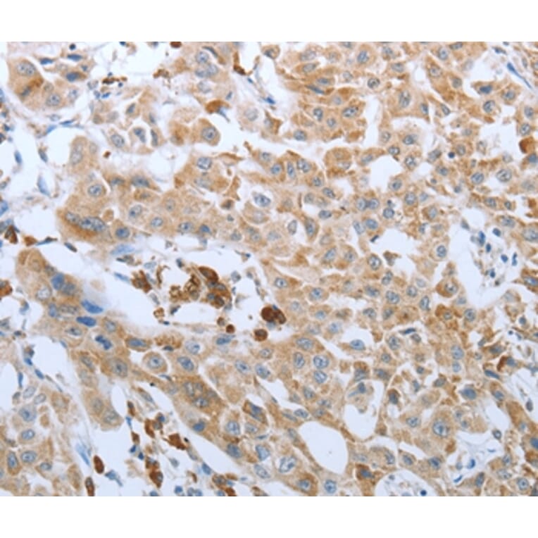 Immunohistochemistry - FGF1 Antibody from Signalway Antibody (36770) - Antibodies.com