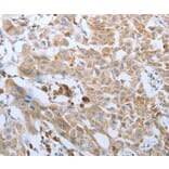 Immunohistochemistry - FGF1 Antibody from Signalway Antibody (36770) - Antibodies.com