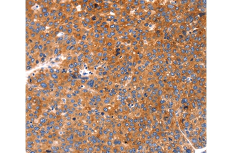 Immunohistochemistry - FGF3 Antibody from Signalway Antibody (36771) - Antibodies.com
