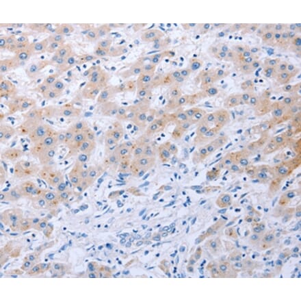 Immunohistochemistry - FGF4 Antibody from Signalway Antibody (36772) - Antibodies.com