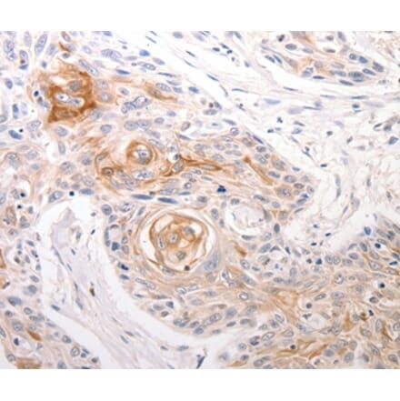 Immunohistochemistry - DFFB Antibody from Signalway Antibody (36776) - Antibodies.com