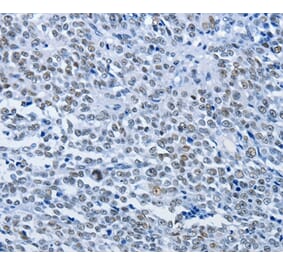Immunohistochemistry - CBX1 Antibody from Signalway Antibody (36779) - Antibodies.com