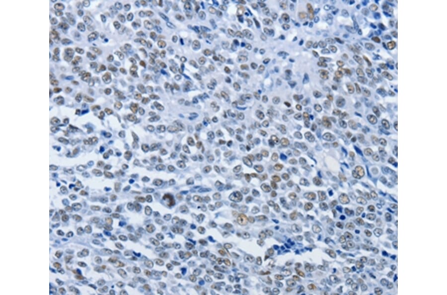 Immunohistochemistry - CBX1 Antibody from Signalway Antibody (36779) - Antibodies.com