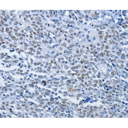 Immunohistochemistry - CBX1 Antibody from Signalway Antibody (36779) - Antibodies.com