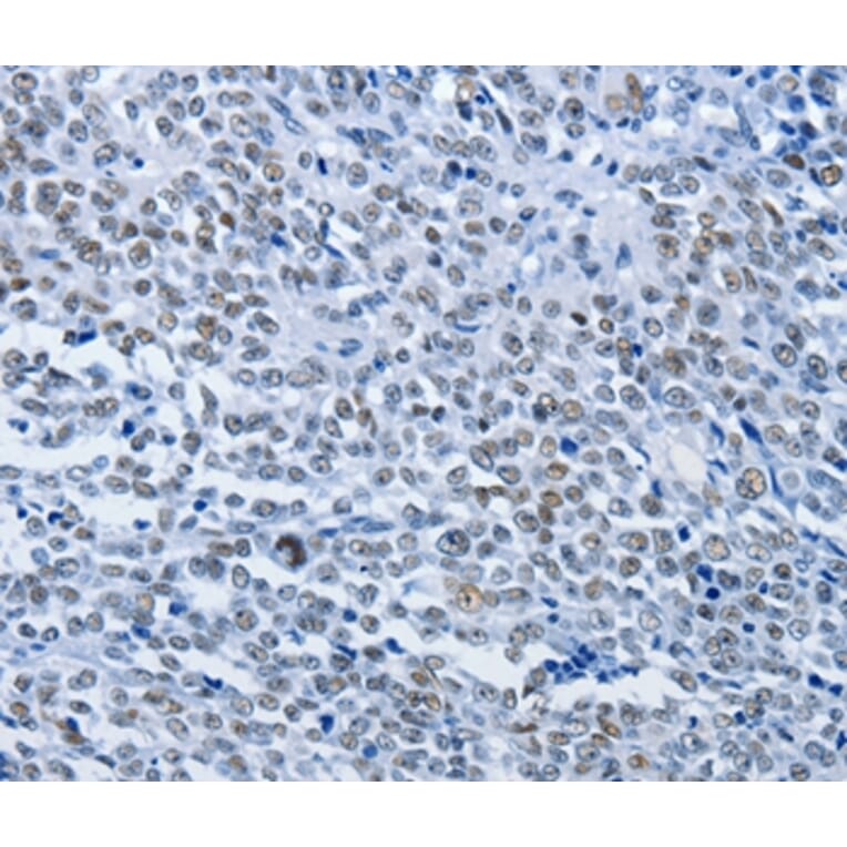 Immunohistochemistry - CBX1 Antibody from Signalway Antibody (36779) - Antibodies.com